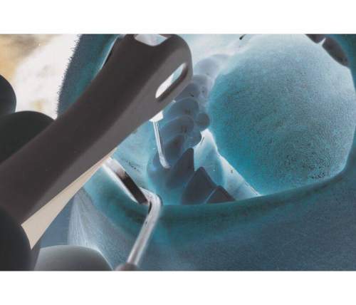 Durr Dental Vector Paro - пародонтологический центр фото 7